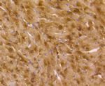 Musashi-2 Antibody in Immunohistochemistry (Paraffin) (IHC (P))