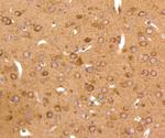 JNK2 Antibody in Immunohistochemistry (Paraffin) (IHC (P))