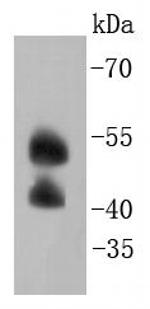 JNK2 Antibody in Western Blot (WB)