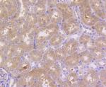 PEBP1 Antibody in Immunohistochemistry (Paraffin) (IHC (P))