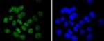 UBC9 Antibody in Immunocytochemistry (ICC/IF)