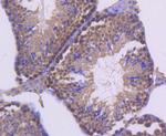 UBC9 Antibody in Immunohistochemistry (Paraffin) (IHC (P))