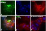 Caspase 6 Antibody in Immunocytochemistry (ICC/IF)