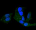 Phospho-PRKAR2A (Ser99) Antibody in Immunocytochemistry (ICC/IF)