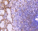 Phospho-PRKAR2A (Ser99) Antibody in Immunohistochemistry (Paraffin) (IHC (P))