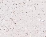 Phospho-ATF2 (Thr71) Antibody in Immunohistochemistry (Paraffin) (IHC (P))