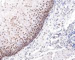 Phospho-ATF2 (Thr71) Antibody in Immunohistochemistry (Paraffin) (IHC (P))