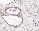 Phospho-ATF2 (Thr71) Antibody in Immunohistochemistry (Paraffin) (IHC (P))