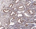 Phospho-ATF2 (Thr71) Antibody in Immunohistochemistry (Paraffin) (IHC (P))