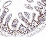 Phospho-ATF2 (Thr71) Antibody in Immunohistochemistry (Paraffin) (IHC (P))