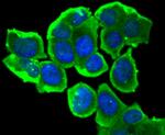 Phospho-Estrogen Receptor alpha (Ser118) Antibody in Immunocytochemistry (ICC/IF)