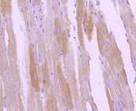 Phospho-TrkB (Tyr817) Antibody in Immunohistochemistry (Paraffin) (IHC (P))