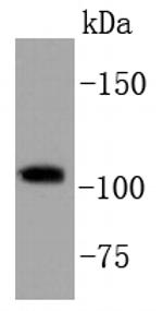 PIK3CB Antibody in Western Blot (WB)