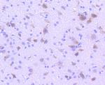 TPH1 Antibody in Immunohistochemistry (Paraffin) (IHC (P))