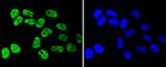 hnRNP K Antibody in Immunocytochemistry (ICC/IF)