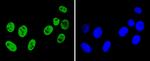 hnRNP K Antibody in Immunocytochemistry (ICC/IF)