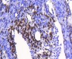 hnRNP K Antibody in Immunohistochemistry (Paraffin) (IHC (P))