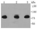 Radixin Antibody in Western Blot (WB)
