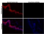 Cytokeratin 14 Antibody in Immunohistochemistry (Paraffin) (IHC (P))