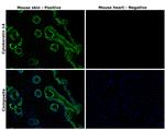 Cytokeratin 14 Antibody in Immunohistochemistry (Paraffin) (IHC (P))