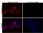 Cytokeratin 14 Antibody in Immunohistochemistry (Paraffin) (IHC (P))