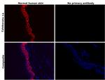 Cytokeratin 14 Antibody in Immunohistochemistry (Paraffin) (IHC (P))