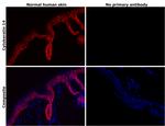 Cytokeratin 14 Antibody in Immunohistochemistry (Paraffin) (IHC (P))