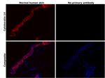 Cytokeratin 14 Antibody in Immunohistochemistry (Paraffin) (IHC (P))