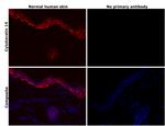 Cytokeratin 14 Antibody in Immunohistochemistry (Paraffin) (IHC (P))