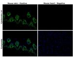 Cytokeratin 14 Antibody in Immunohistochemistry (Paraffin) (IHC (P))