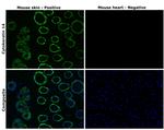 Cytokeratin 14 Antibody in Immunohistochemistry (Paraffin) (IHC (P))