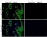 Cytokeratin 14 Antibody in Immunohistochemistry (Paraffin) (IHC (P))