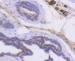 Cytokeratin 14 Antibody in Immunohistochemistry (Paraffin) (IHC (P))