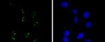 WT1 Antibody in Immunocytochemistry (ICC/IF)