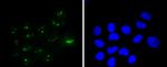 WT1 Antibody in Immunocytochemistry (ICC/IF)