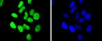 CHK2 Antibody in Immunocytochemistry (ICC/IF)