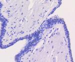 CHK2 Antibody in Immunohistochemistry (Paraffin) (IHC (P))