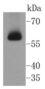 CHK2 Antibody in Western Blot (WB)