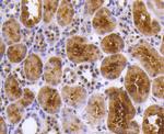 PRP19 Antibody in Immunohistochemistry (Paraffin) (IHC (P))