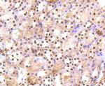 PRP19 Antibody in Immunohistochemistry (Paraffin) (IHC (P))