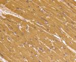 Myoglobin Antibody in Immunohistochemistry (Paraffin) (IHC (P))