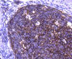 CD21 Antibody in Immunohistochemistry (Paraffin) (IHC (P))