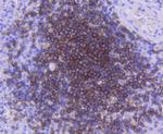 CD21 Antibody in Immunohistochemistry (Paraffin) (IHC (P))