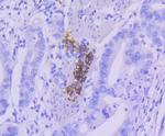 CD21 Antibody in Immunohistochemistry (Paraffin) (IHC (P))