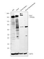 CD21 Antibody in Western Blot (WB)