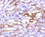 HLA-DR Antibody in Immunohistochemistry (Paraffin) (IHC (P))