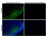 HLA-DR Antibody