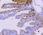 WAVE2 Antibody in Immunohistochemistry (Paraffin) (IHC (P))