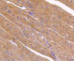 ATG9A Antibody in Immunohistochemistry (Paraffin) (IHC (P))