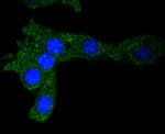 Ferritin Antibody in Immunocytochemistry (ICC/IF)